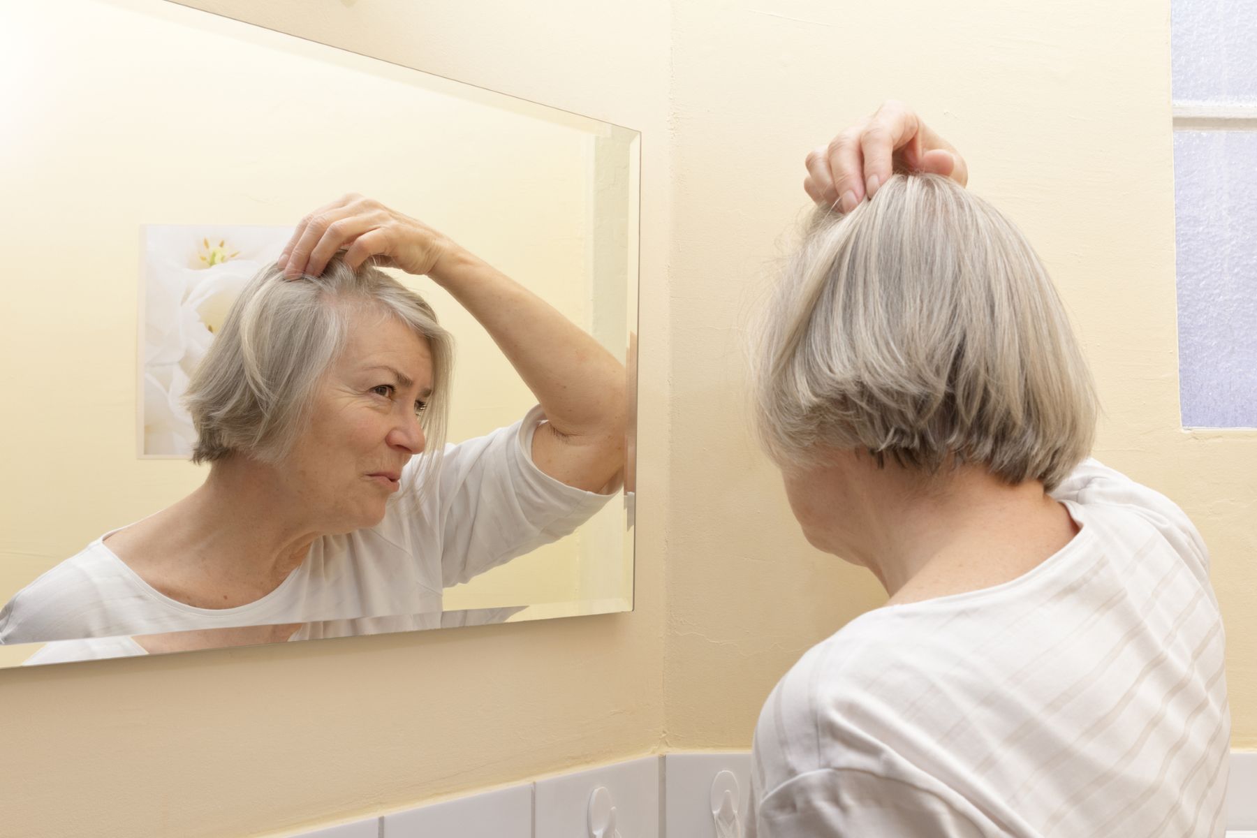 woman with menopausal hair loss