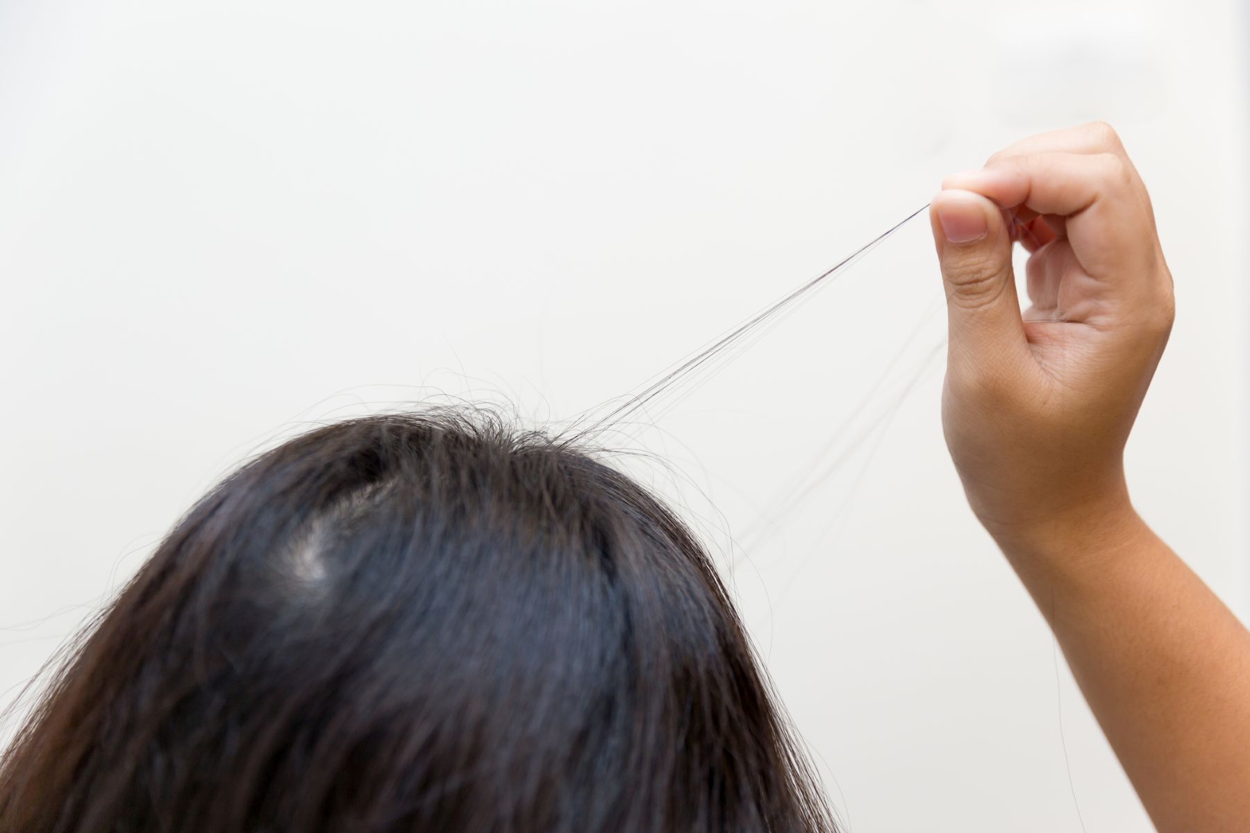 why is my hair thinning at 20 female: trichotillomania