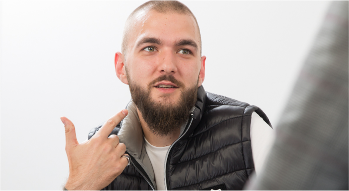 After beard hair transplant