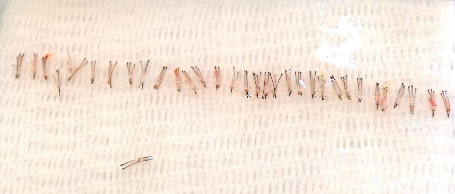 Extracted hair grafts