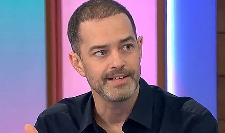 Lee Mead Hair Transplant