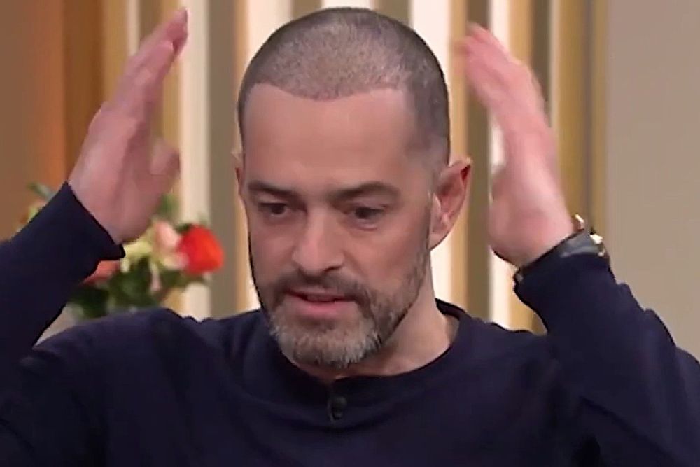 Lee Mead&rsquo;s hair transplant recovery