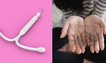 Mirena IUD Hair Loss Causes, Symptoms And Solutions