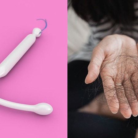 Mirena IUD Hair Loss Causes, Symptoms and Solutions