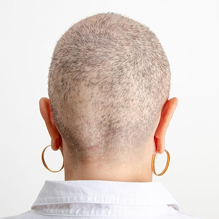 How to Stop Hair Loss at the Back of the Head for Females