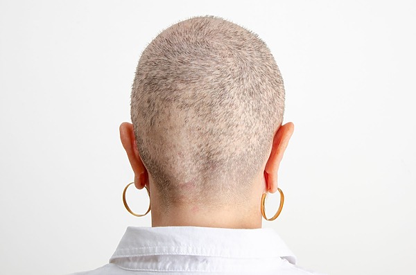 How to Stop Hair Loss at the Back of the Head for Females