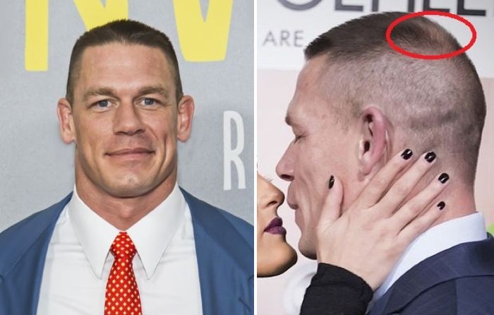 John Cena first signs of hair loss