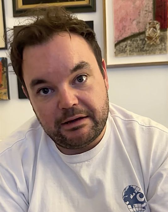 Lloyd Griffith's hair loss covered with hair fibres