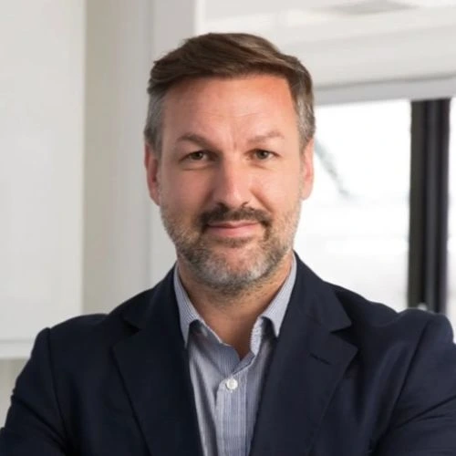 Results of James Waltons hair transplant at the Wimpole Clinic