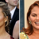 Chrissy Teigen’s Eyebrow Transplant: Overplucked Brow Transformation