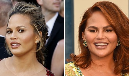 Chrissy Teigen Before And After Eyebrow Transplant