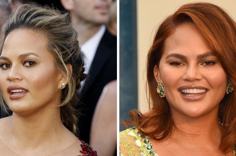 Chrissy Teigen Before And After Eyebrow Transplant