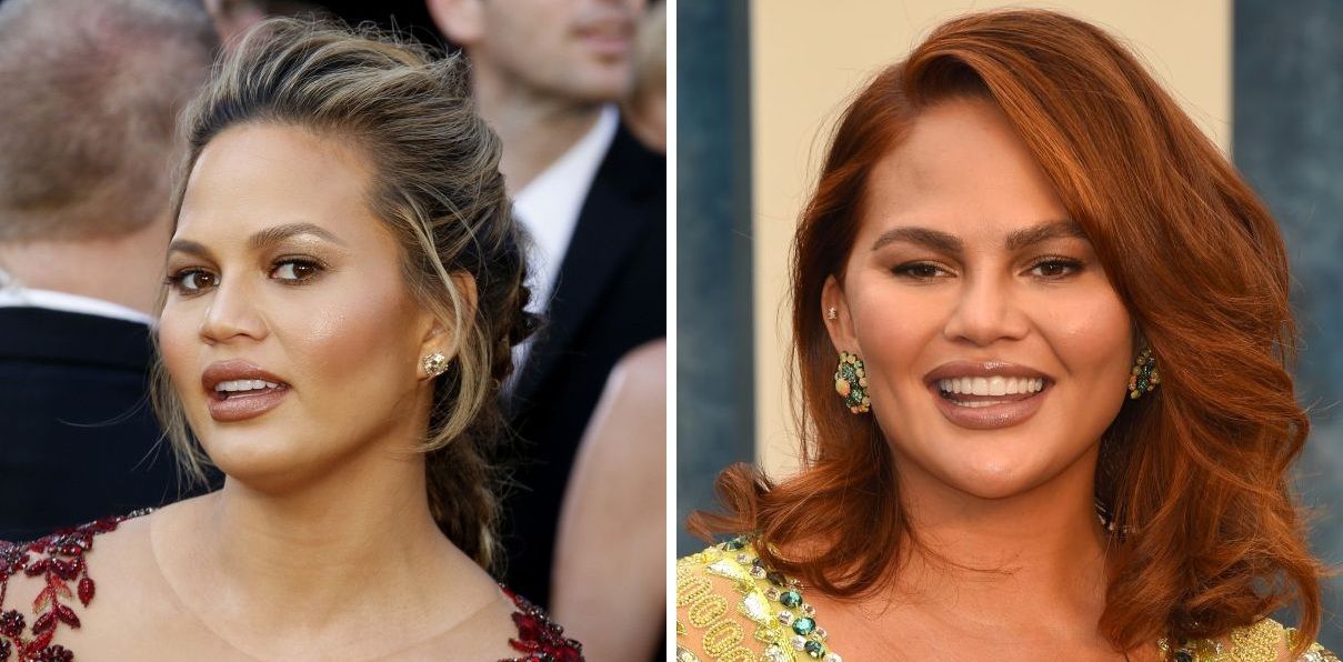 Chrissy Teigen before and after eyebrow transplant