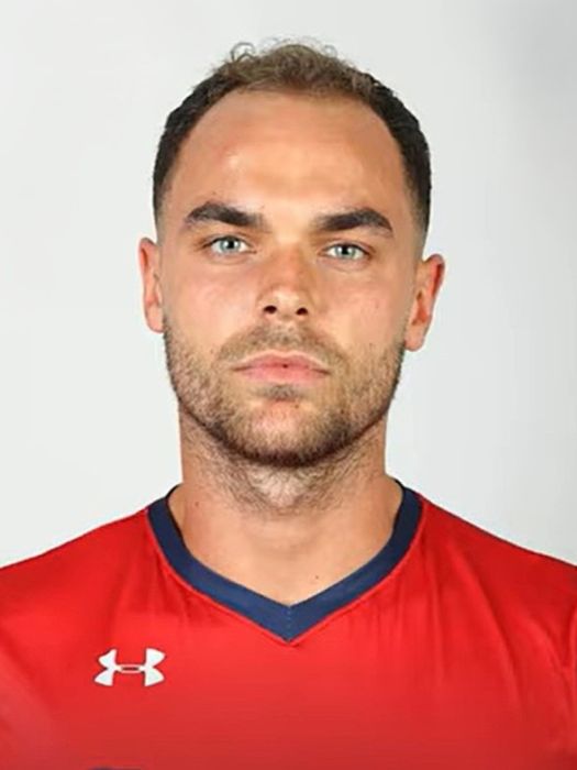 Harry Cooksley before hair transplant