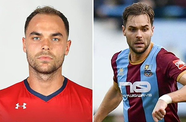 All About Harry Cooksley from Love Island&rsquo;s Hair Transplant