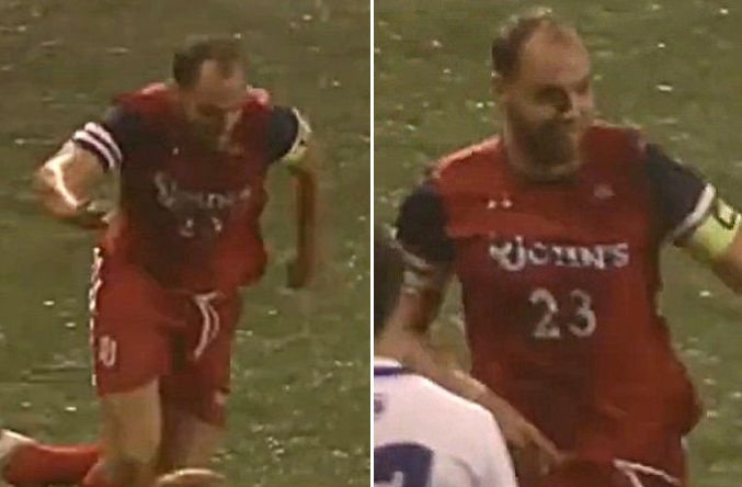 Harry Cooksley m-shaped hairline and hair loss