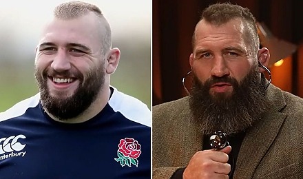Joe Marler Hair Transplant