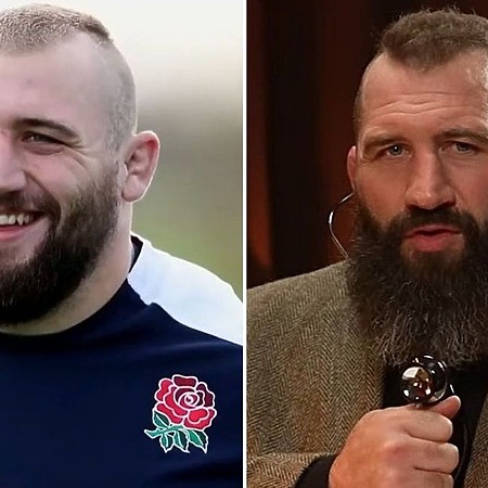 Joe Marler Hair Transplant