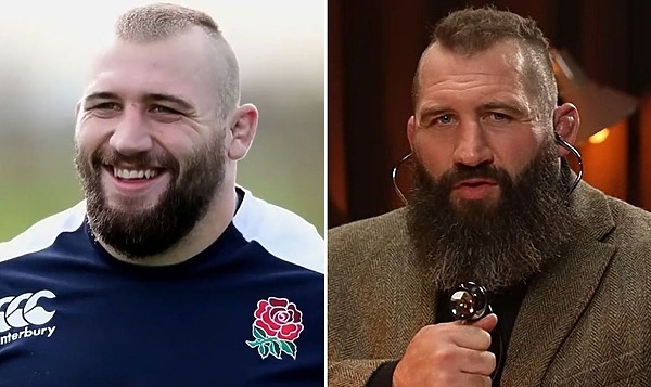 Joe Marler Hair Transplant