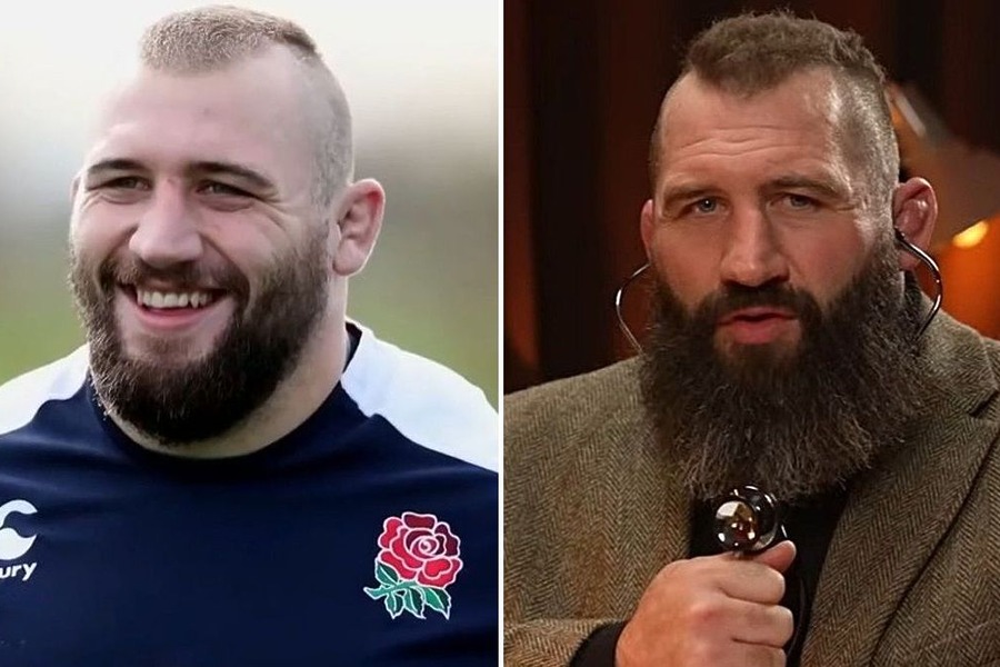 Joe Marler Hair Transplant