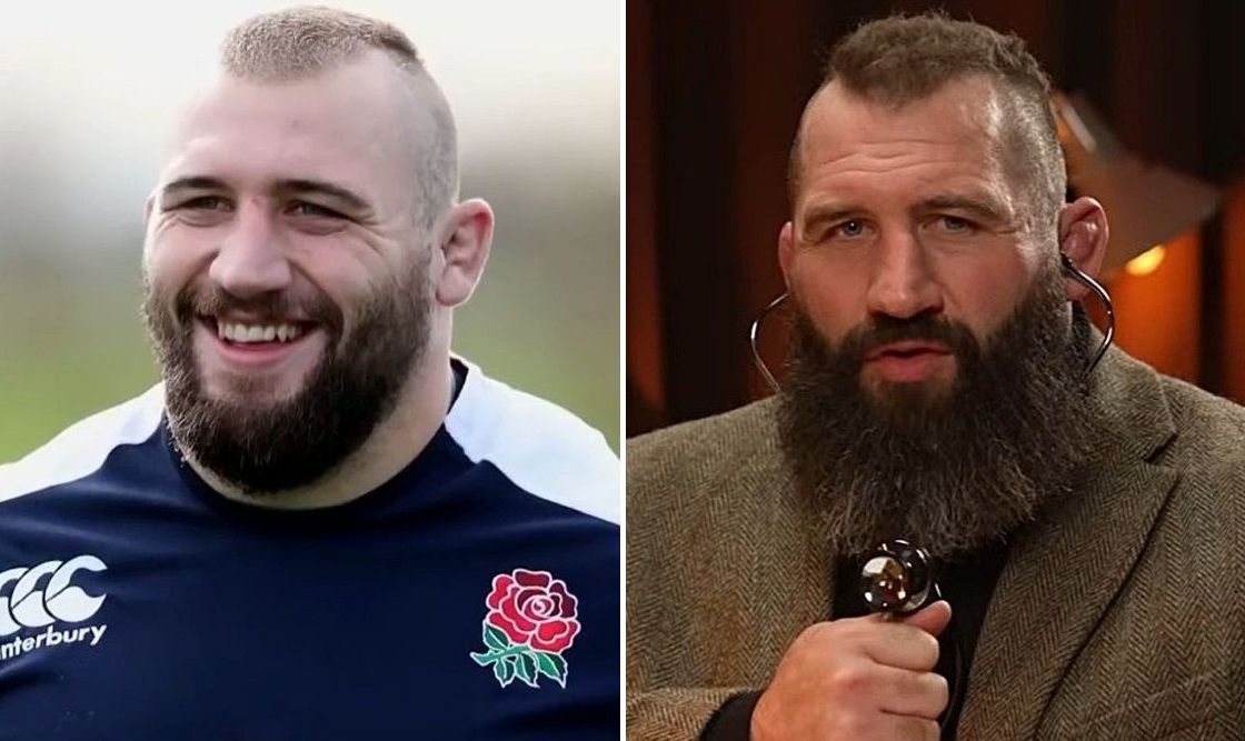 Joe Marler Hair Transplant