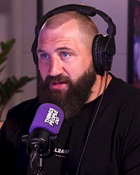 Joe Marler after hair transplant