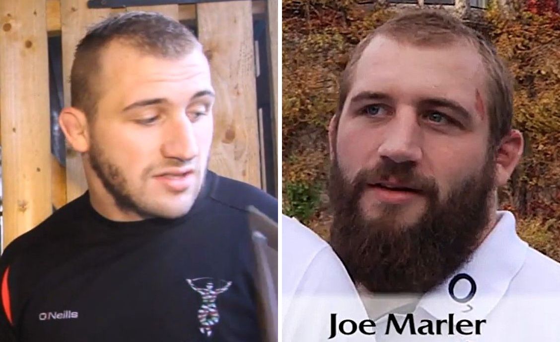 Joe Marler hair loss