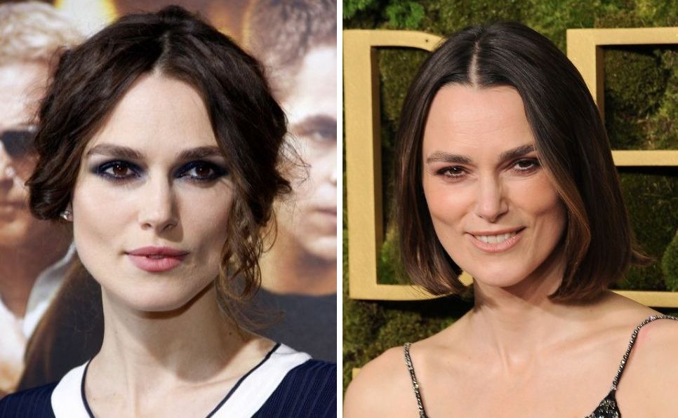 Keira Knightley hair loss