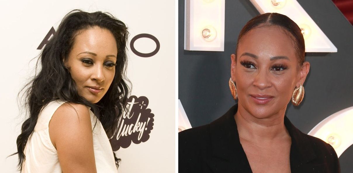 Lisa Maffia before and after hair transplant