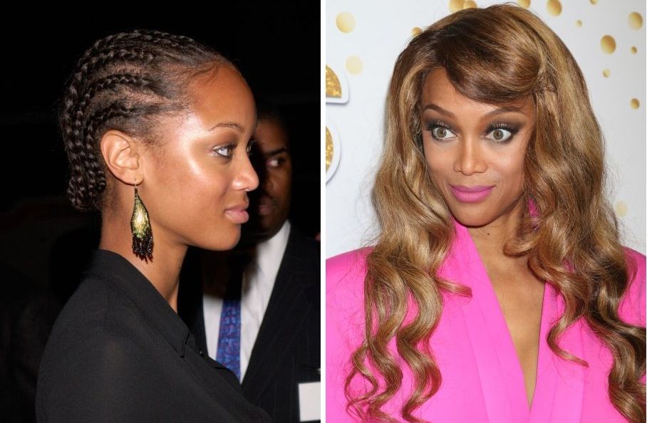 Tyra Banks hair loss