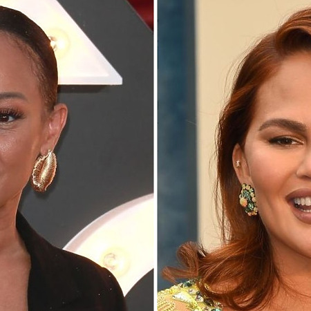 female celebrity hair transplants