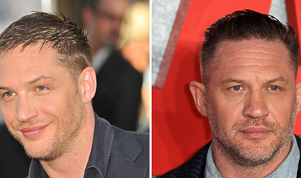 Tom Hardy Hair Transplant Featured Image