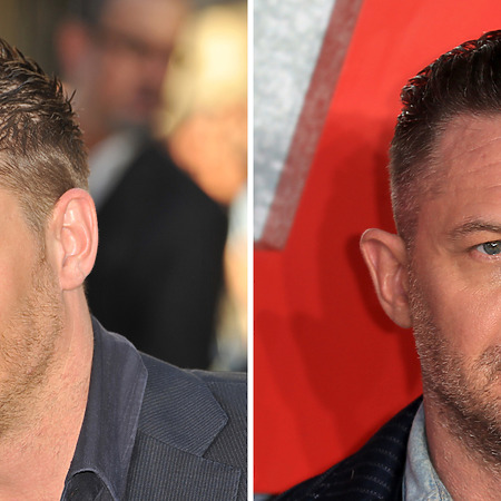 tom hardy hair transplant featured image