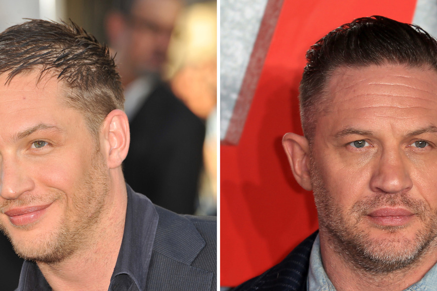 Tom Hardy Hair Transplant Featured Image