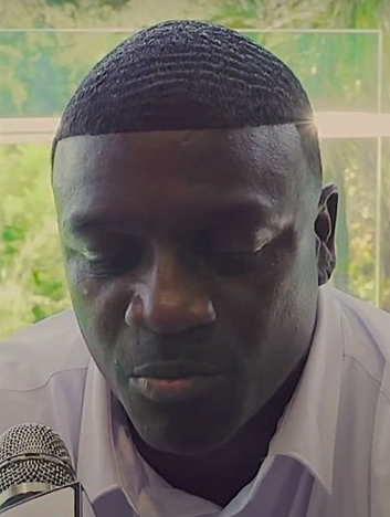 Akon's overly straight hairline