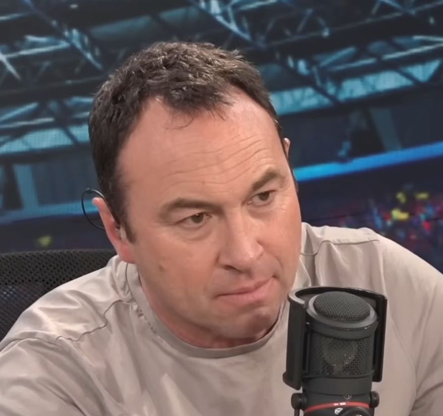 Jason Cundy before hair transplant