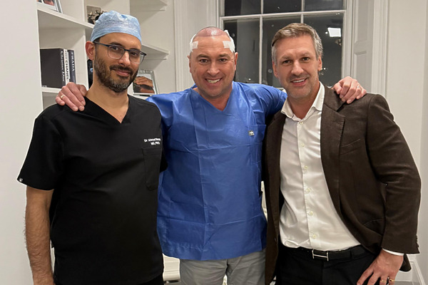 Jason Cundy hair transplant