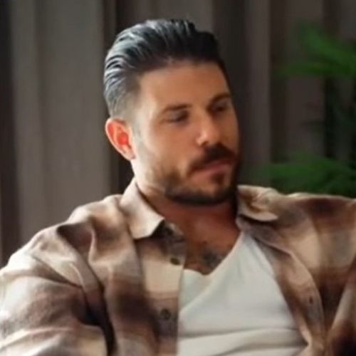 Paul Antoine hair loss