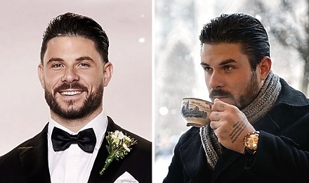 Paul Mafs Hair Transplant