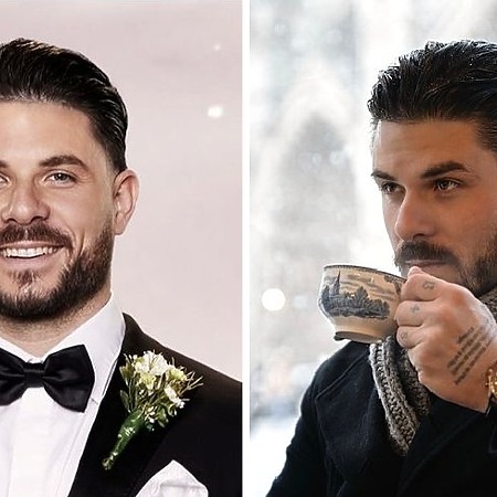 paul mafs hair transplant