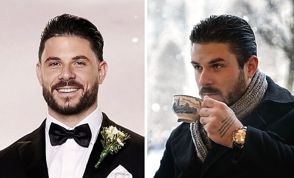 paul mafs hair transplant