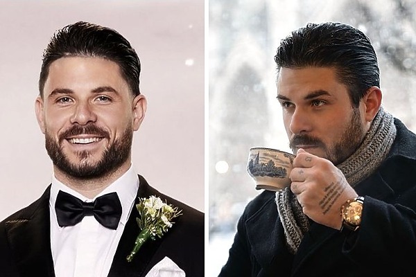 Paul Mafs Hair Transplant