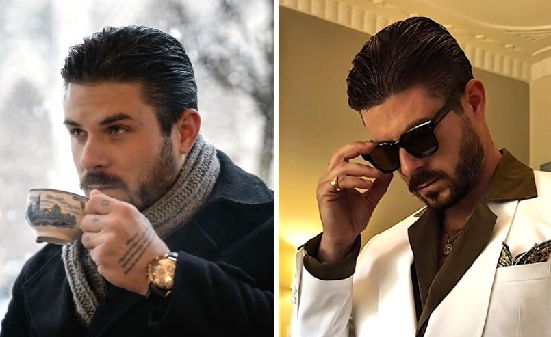 Paul Antoine new hairline