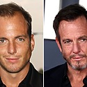 Has Will Arnett Had A Hair Transplant?