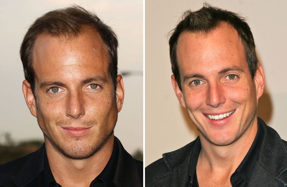 Will Arnett in 2003 (left) and in 2005 (right)