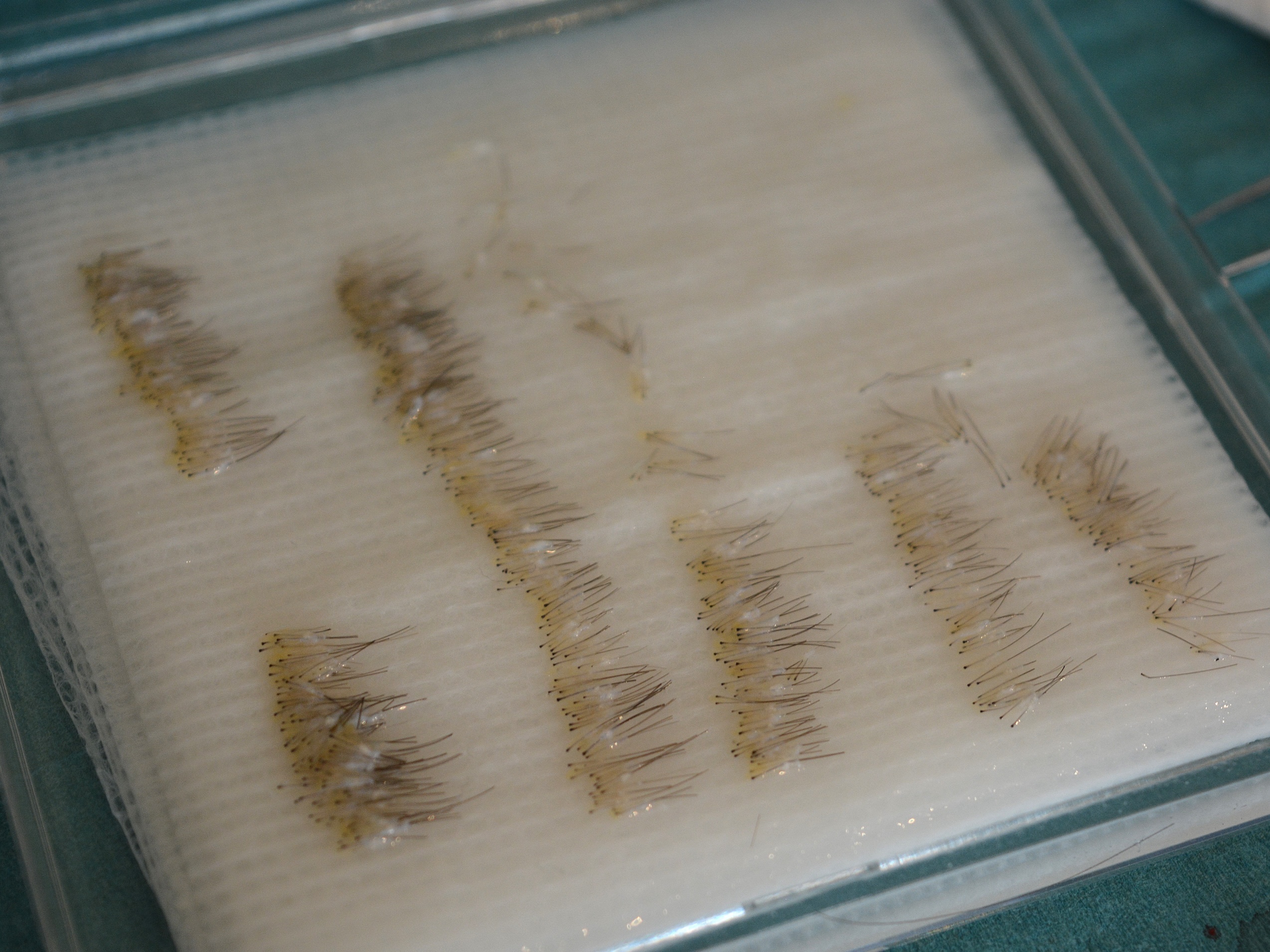 group of extracted hair grafts
