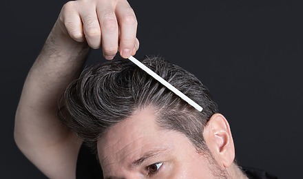 Hair Replacement Service