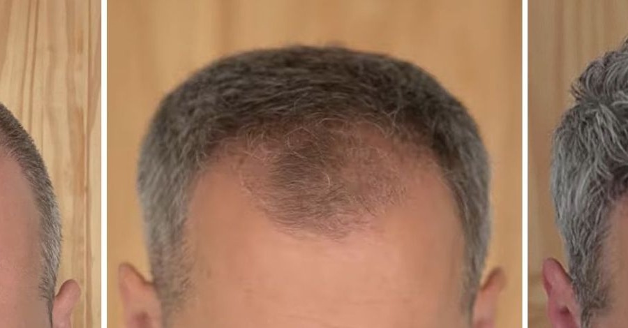 How Long Does It Take For Hair To Grow Back