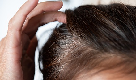 Does Stress Cause Grey Hair