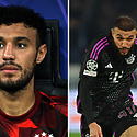 Noussair Mazraoui Hair Transplant: Photos, Results, Timeline